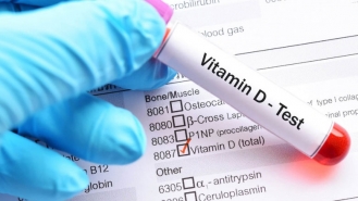 هر آنچه که باید در رابطه با اثرات ویتامین دی در مقابله با ویروس کرونا بدانید