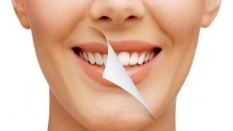 چه روش‌هایی برای سفیدشدن دندان وجود دارد؟